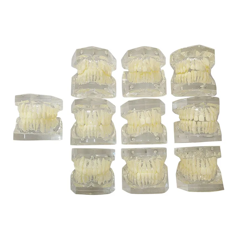 

YTYIN Transparent Ortho Classification Teaching Orthodontic Model Set