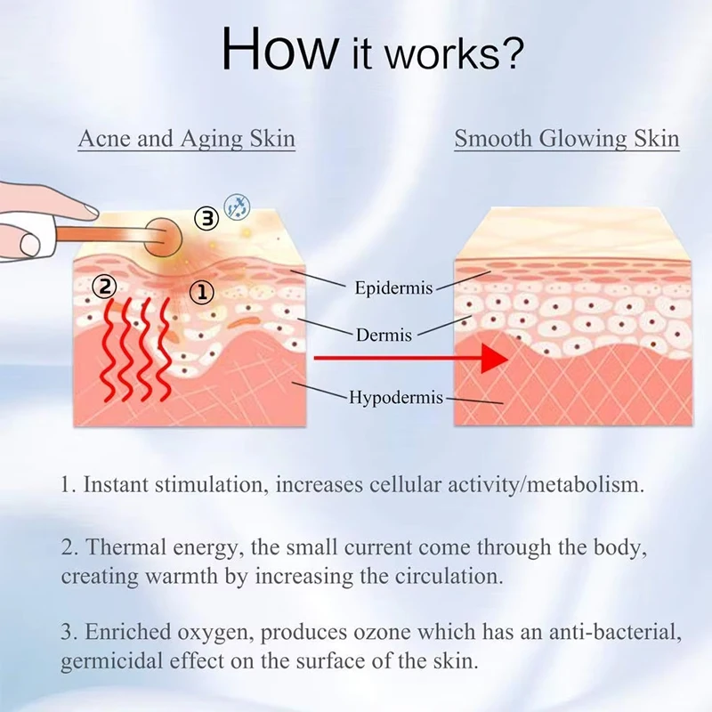 Machine professionnelle portative portative de thérapie de peau baguette traitement de l'acné à haute fréquence ascenseur du visage ciblé pour les soins de la peau du visage