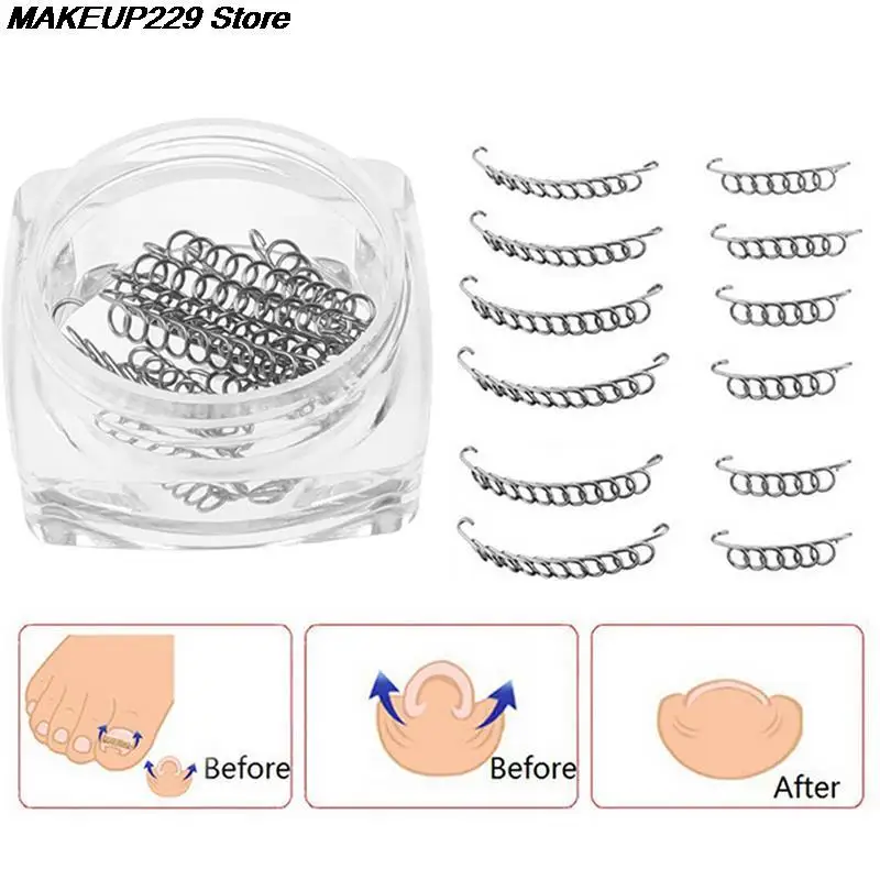 New 12pcs Ingrown Toe Nail Correction Wire Fixer Pedicure Paronychia Recover Toenails Corrector Foot Care Tool