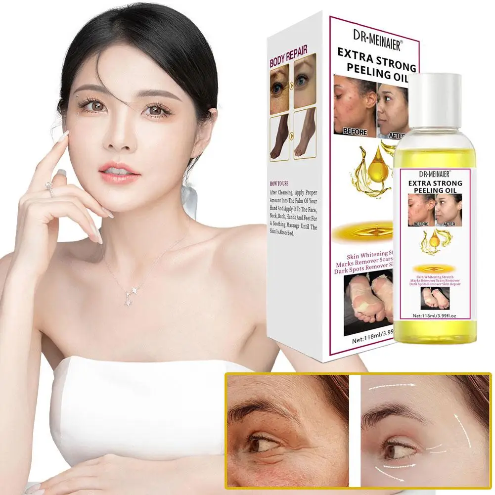 Minyak pengelupas kuning 118ml, Eksfoliasi lengan Serum perawatan pencerah kulit kaki tubuh mati L9V7