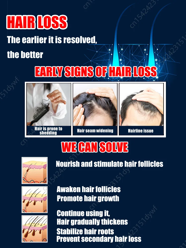 Hair Care Essence Oil Hair Growth Liquid Nourishing Scalp Awaken Hair Follicles Prevent Hair Loss