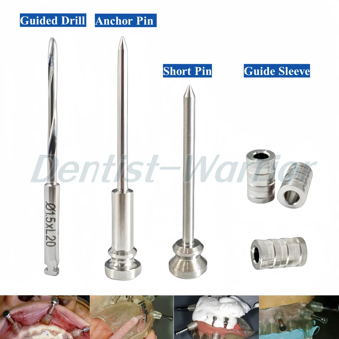 

⌀ 1,5 мм стоматологические направляющие анкерные штифты, длинные/короткие направляющие спиральные сверла, фиксирующие штифты для шаблонов имплантатов