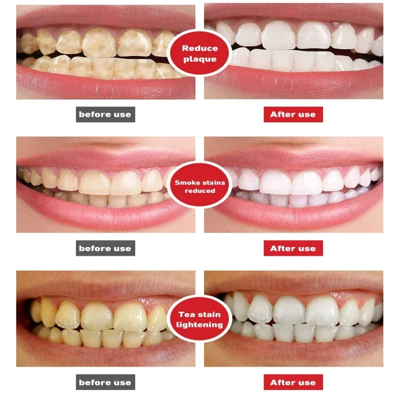 Toothpaste Quick Repair Cavities Caries Probiotic Clean Whiten Remove Yellow Plaque Protect Gum Reduce Tooth Stains Fresh Breath