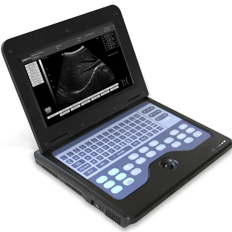 

Real manufacturer CONTEC CMS600P2 portable b ultrasound machine