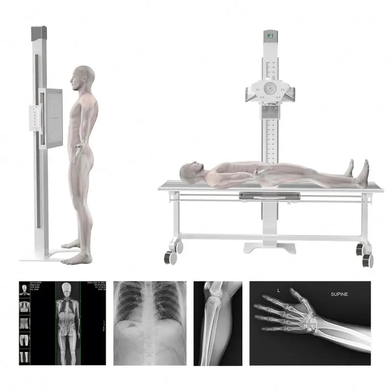 CE Certified 20kw Class II Medical Radiography Diagnostic Double Column Electricity X-Ray Machine for Hospital Use Equipment