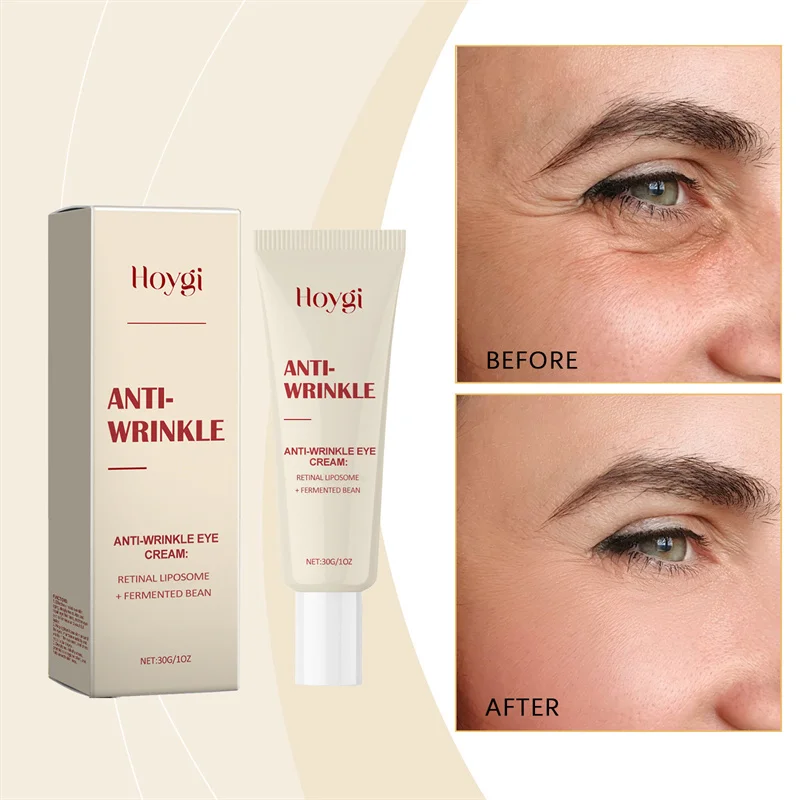 

Seoul 1988 Retinol Eye Cream 4% Anti Aging Eye Treatment Dark Circles, Wrinkles, Puffiness Firming & Lifting Eye Cream For Women