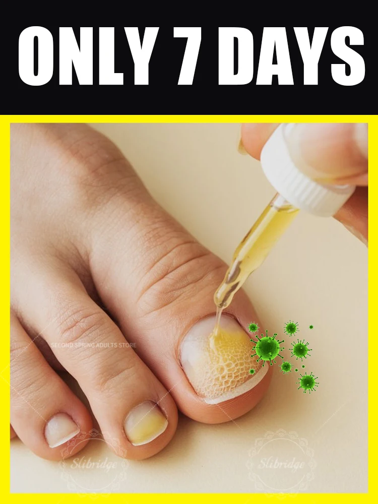 

manicure for bad Can in 7 days farewell