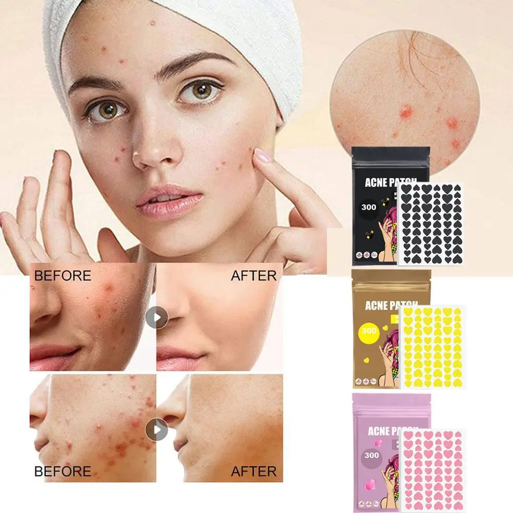 300pcs/set Face Skin Care Acne Pimple Patch 2 Sizes Invisible Professional Healing Absorbing Spot Sticker Covering For Men G3S3