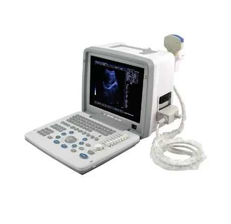 Multifunction Pregnancy Ultrasound Scanner Portable Ultrasound Machine