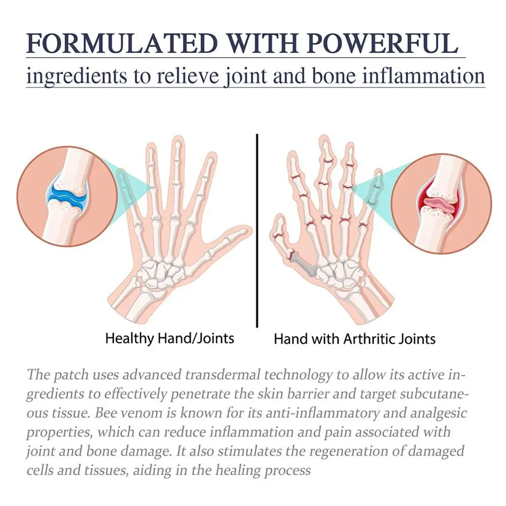 5x 30G Bijengif Gezamenlijke Verzorgingscrème Verlicht Cervicale Gewrichtspijn Massagebehandelingen Crème Botgezondheid Lichaamsverzorgingstools