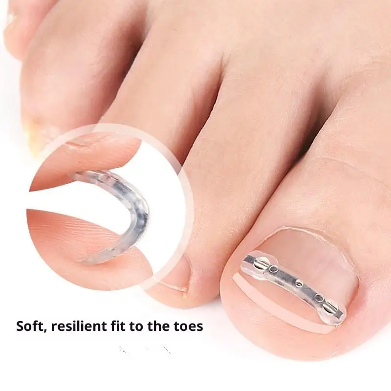Corrector de uñas encarnadas, herramientas para pedicura, recuperación integrada, tratamiento de uñas de los pies, soporte profesional para alisar uñas encarnadas