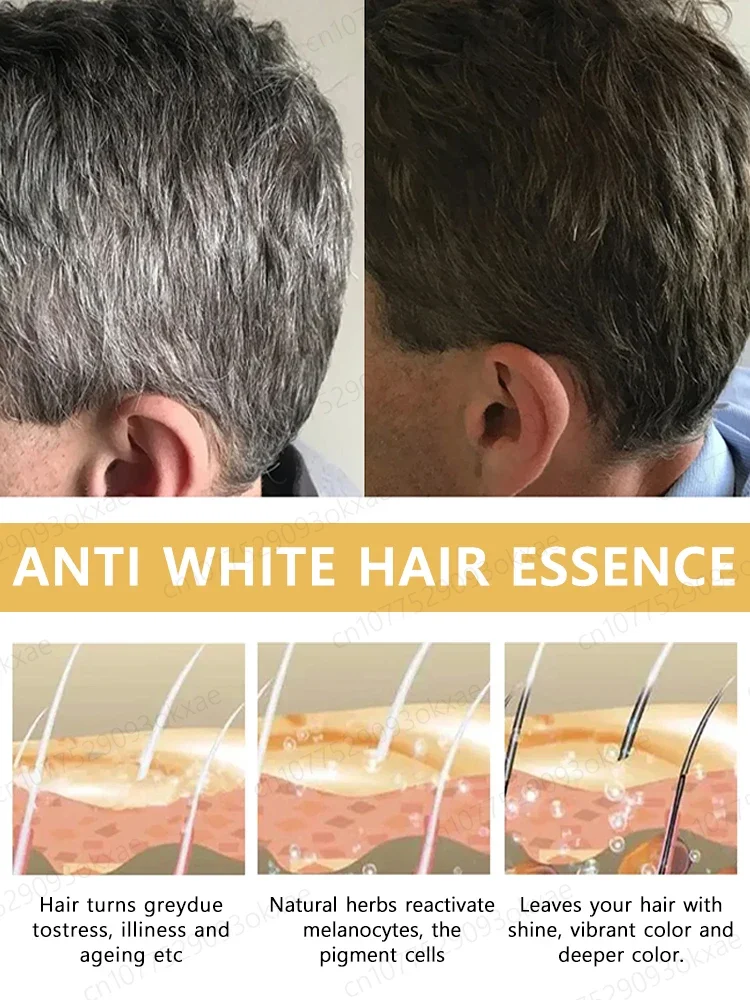 White hair killer, remove gray hair and restore natural hair color in 7 days