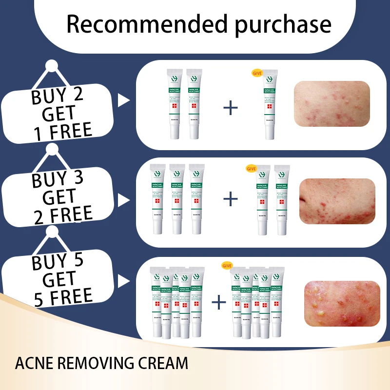 Acne Removal Whitening Cream Effective Fade Acne Spots Repair Gel Oil Control Moisturizing Shrink Pores Acne Treatment Skin Care