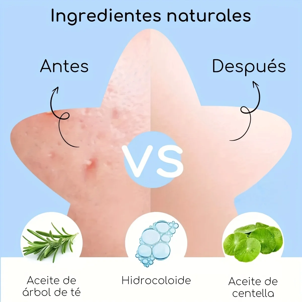 Patches de acne pretos em forma de estrela em caixa espelhada de 60 peças – hidrocolóide, ocultando, leve e para limpar os poros