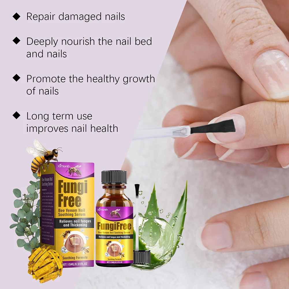 Nails Onychomycosis Treatments Liquid Natural Plant Formulas Nail Care Liquid For Broken Nails Nourishing