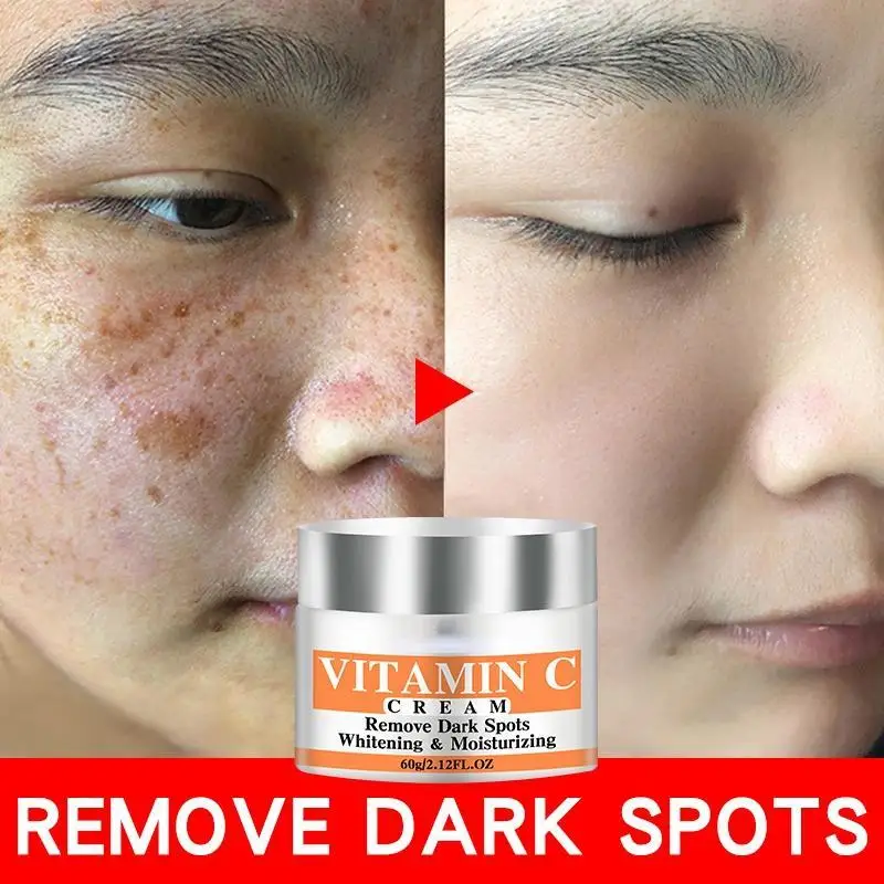 Mais novo vitamina c clareamento creme facial reparação fade sardas remover manchas escuras melanina removedor clareamento creme facial