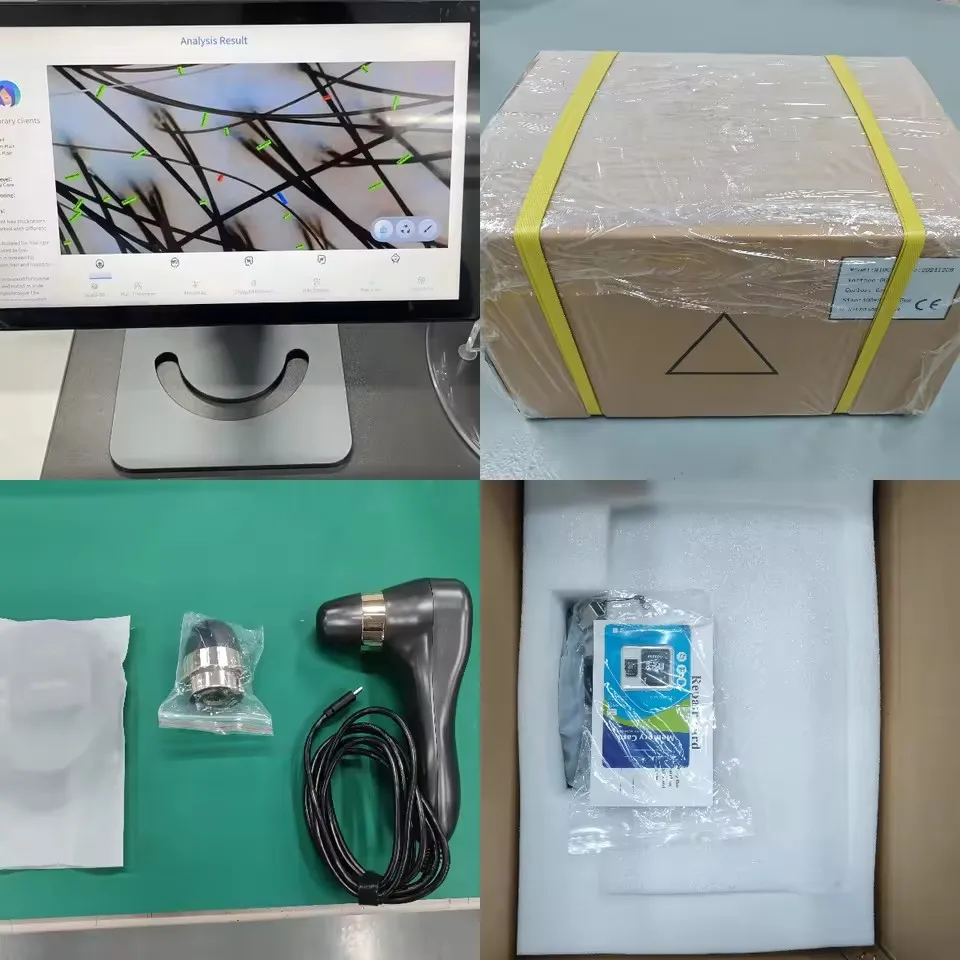AI Smart Scalp Detector Machine Analyze the Scalp Health Status Fast Speed Stable Software Hair Detection Hair Care Instrument