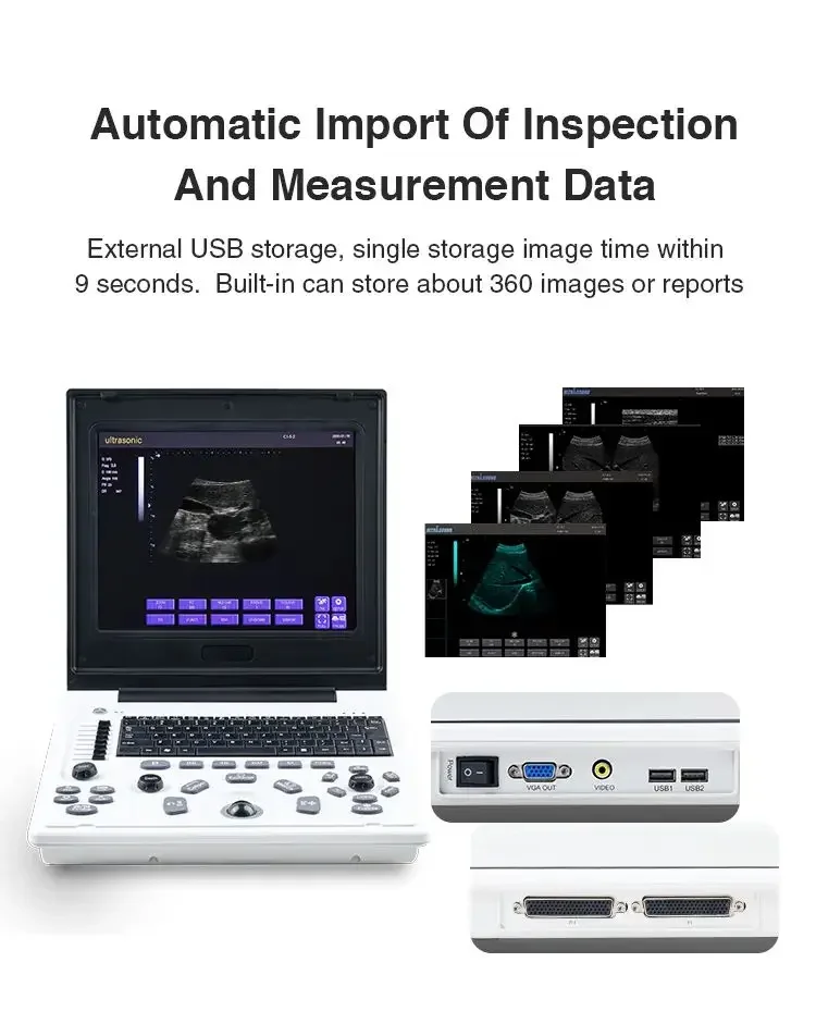 Digital Echocardiography Instruments Sonography Ultrasonography Laptop Black And White Portable Medical Ultrasound Scanner USG