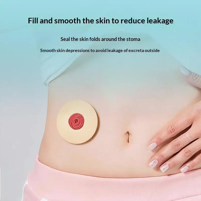 10-pecas-aneis-de-vedacao-para-bolsas-de-ostomia-antivazamento-acessorios-para-estoma-protecao-da-pele-suprimentos-para-cuidados-com-baseplate