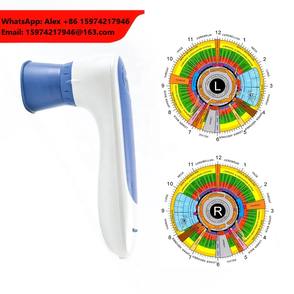 Digital Scanner Skin Iridoscope Irisearch Pro Iriscope Camera Iriscope Iris Analyzer Iridology Camera With Pro Iris Software
