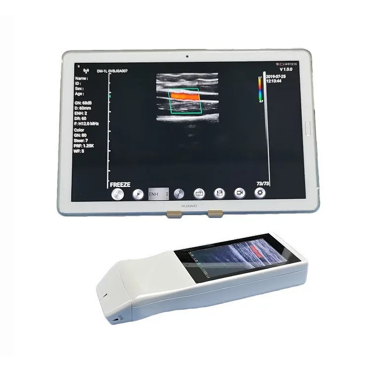 YSB-V5P handheld portable color WIFI touch screen color smartphone ultrasound machine