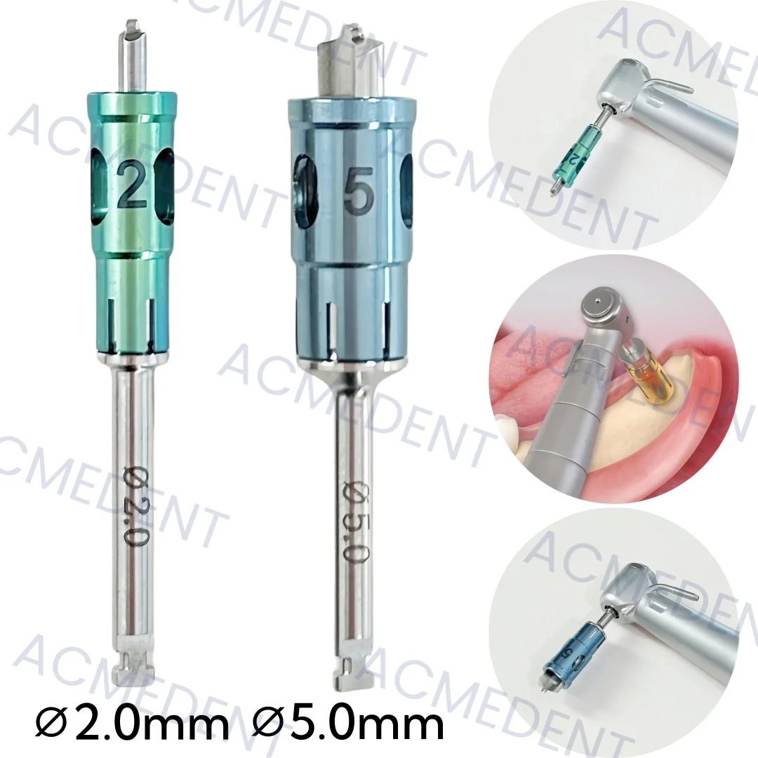 

2Sizes Dental Bone Collector Drills NLBC Never Loss Stopper Self Bone Power Gain Autobone Chip Maker ∅2.0/∅5.0 1-10 шт.