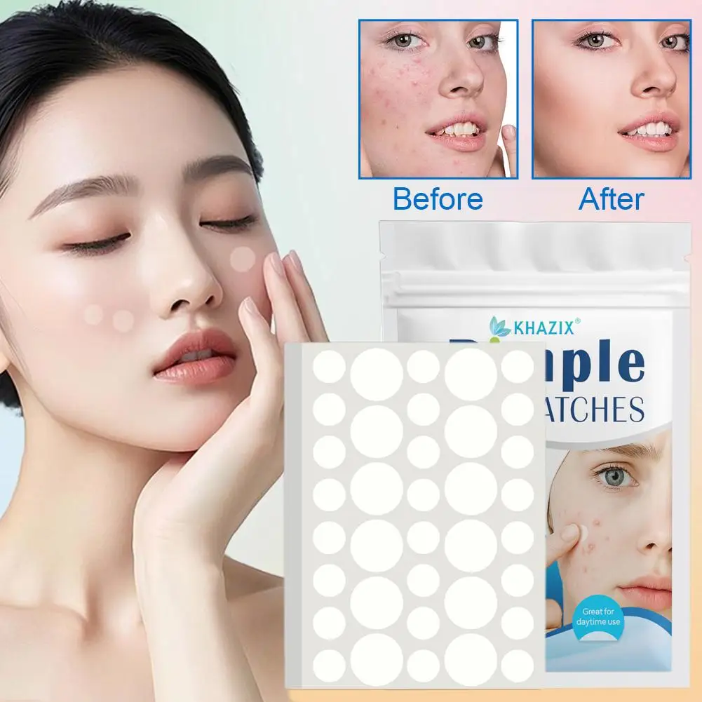Remendo transparente para acne, corretivo invisível, limpeza suave, comedões, cravos, ferramentas faciais, pele fechada, cosméticos wo h1a9