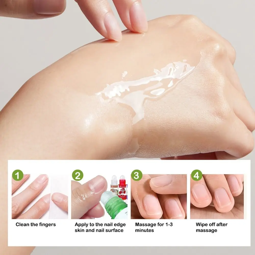 Feuchtigkeitsspendendes 5 ml Nagelernährungsöl, verhindert Heilmittel, Nagelhautreparaturöl, nährt die Haut, Haut, Widerhaken, Nagelbehandlung für die Nagelpflege