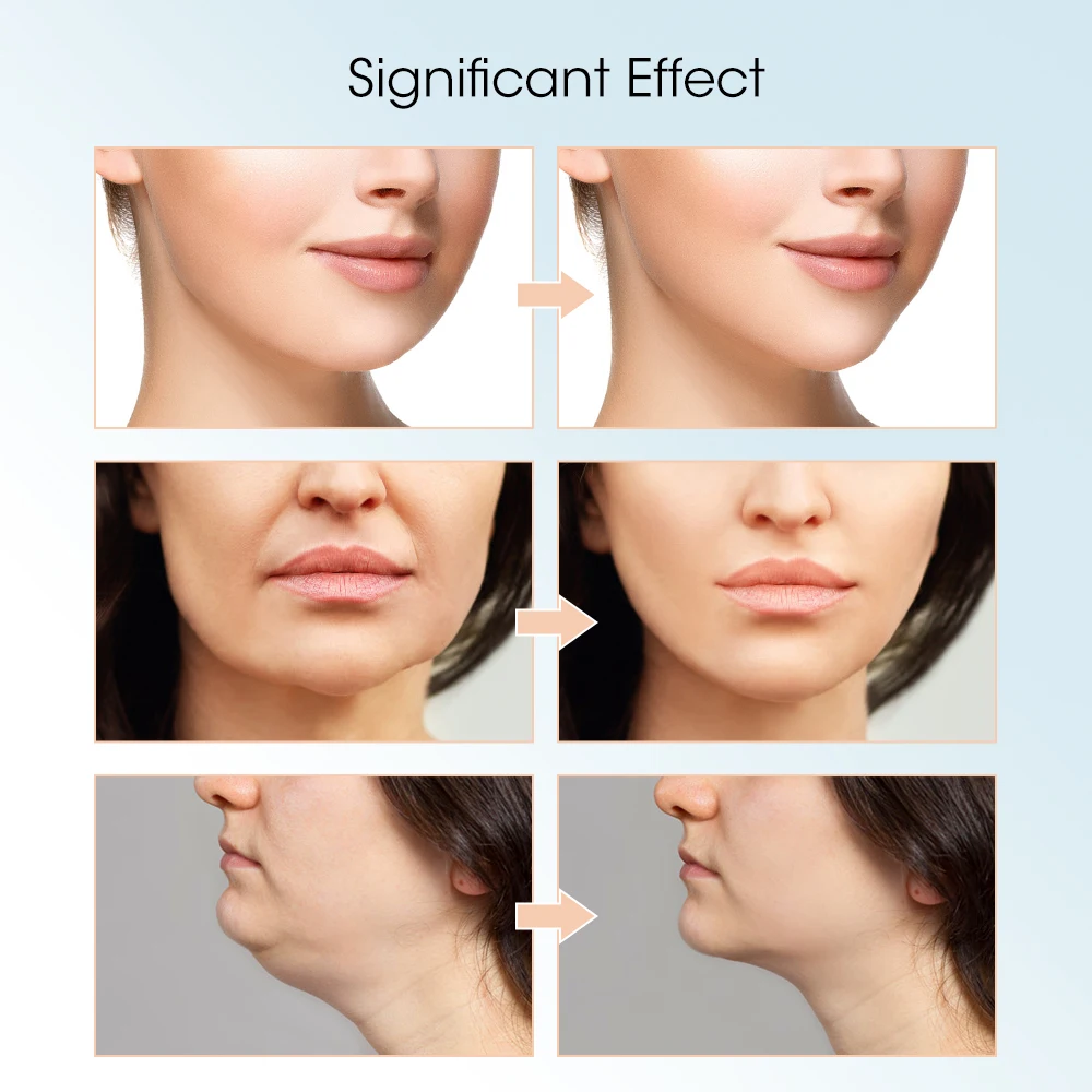 Gesichts Lifting Gerät Gesicht Abnehmen Massagegerät Doppel Kinn Entfernung V Linie Lift Gürtel V Gesicht Shaper Hautpflege Schönheit Instrument