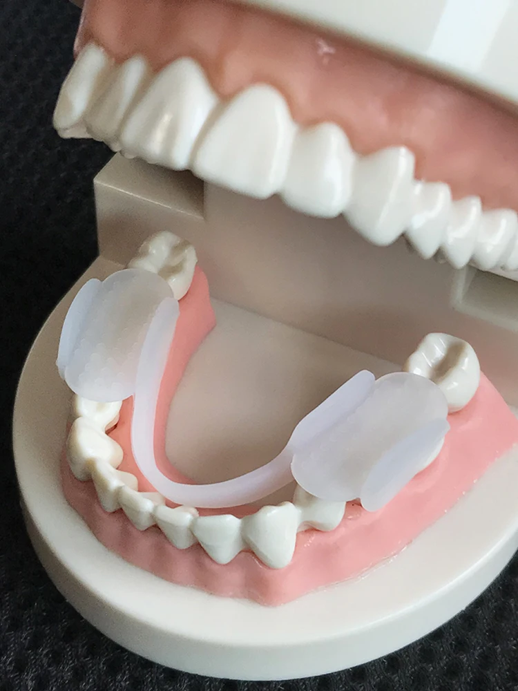 2Pcs Dental Mouth Guard Soft Night Anti-wear Pads Universal Anti-wear Silicone Tooth Pad for Grinding Clenching Teeth at Night