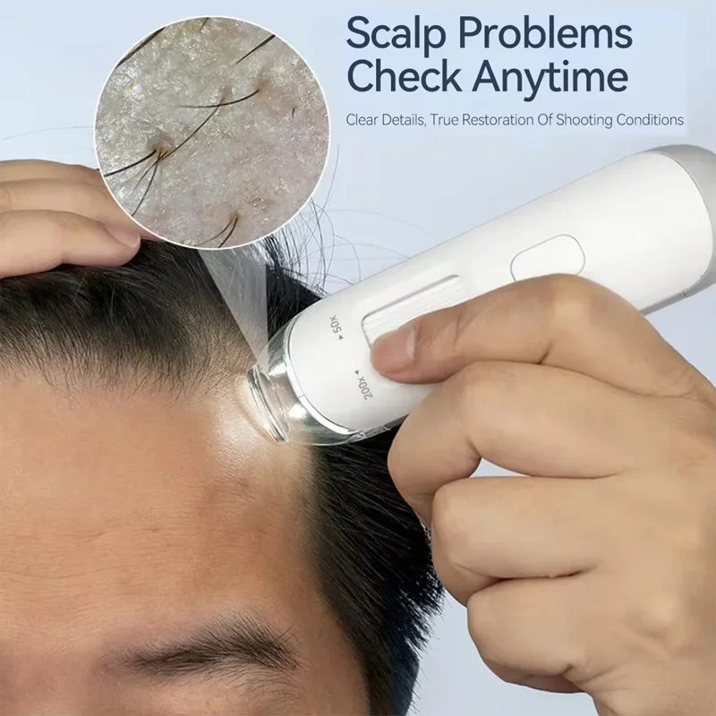 Scalp Detection Device For Home Amateur Use High cost Performance Authentic 200 X Magnifier Skin Analyzer Machine USB Connection