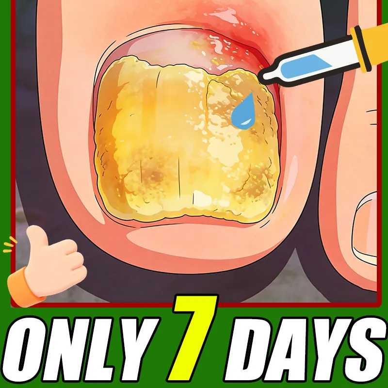 

Let you have beautiful feet and bloom with confidence