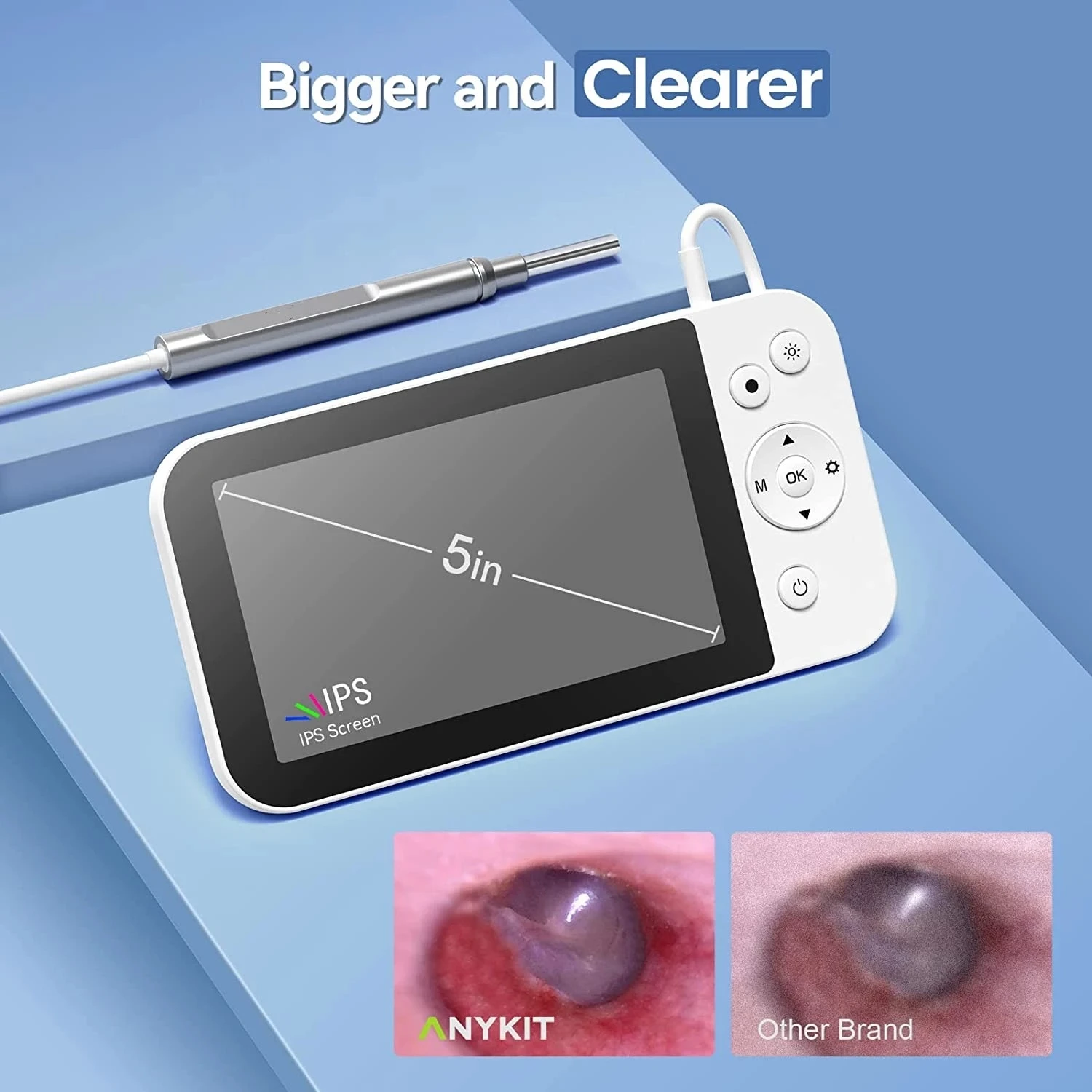 5Inch Screen 3.9mm Lens Ear Endoscope Camera With 6 LEDs And 2500mAH Battery Professional Visual Cleaning Otoscope TF Card