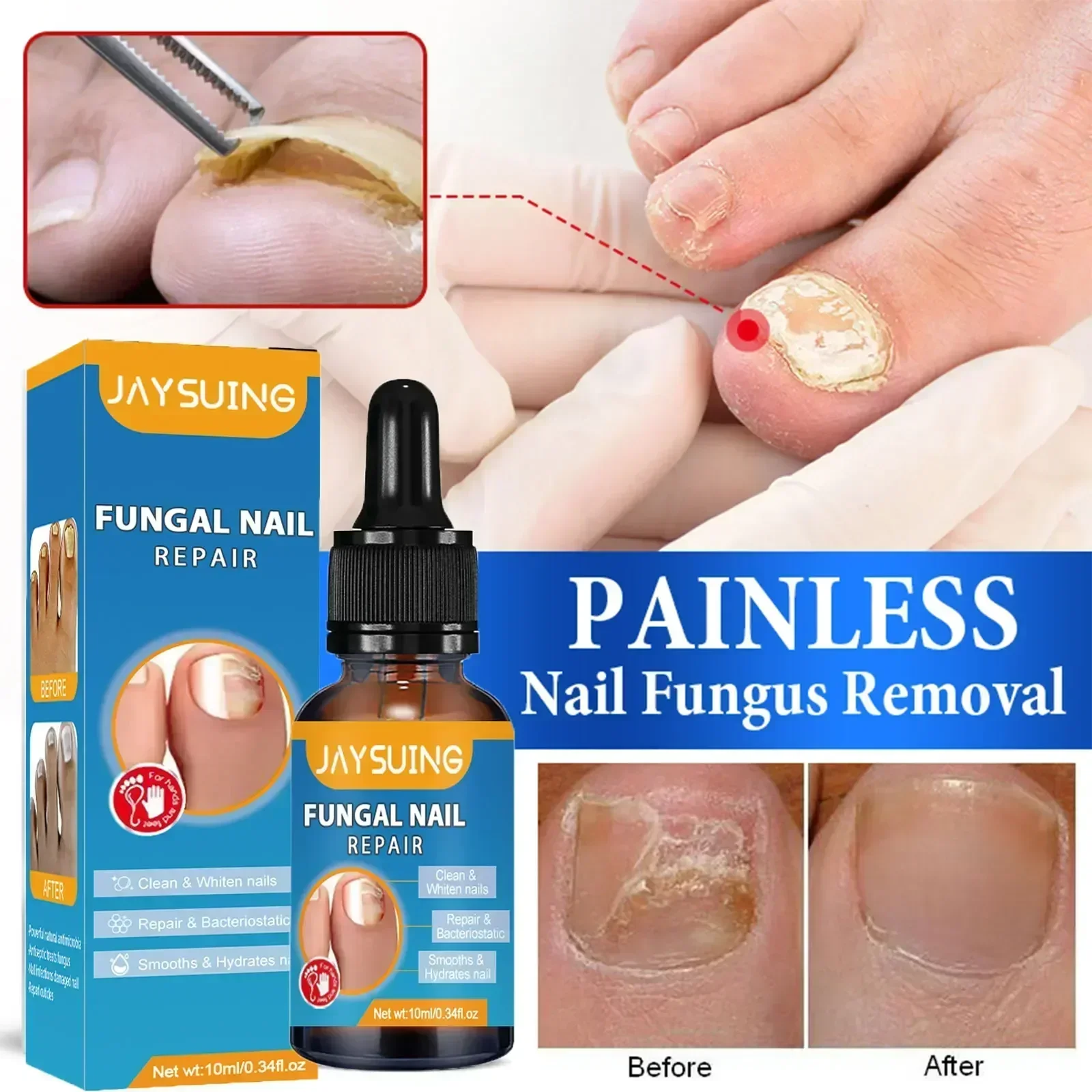 Aceite para tratamiento de uñas fungicida, esencia para reparación de pies, Gel para eliminación de hongos en las uñas de los pies, crema antiinfección, 10ML0903