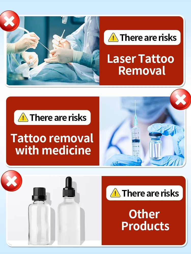 جل إزالة الوشم يذوب الوشم ويصلح البشرة وترطيبها والعناية بالتنظيف العميق وغير المؤلم #4