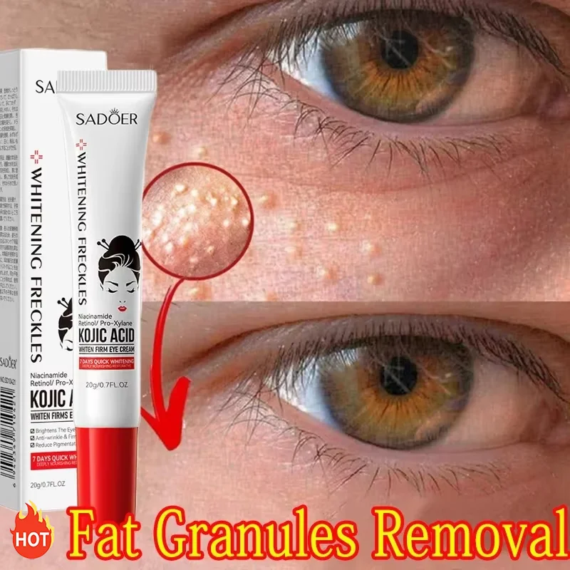 Fat Granules Remover Eye Cream Reduce Dark Circles Fade Fine Lines Repair Barrier Anti-Puffiness Anti Inflammatory Cream