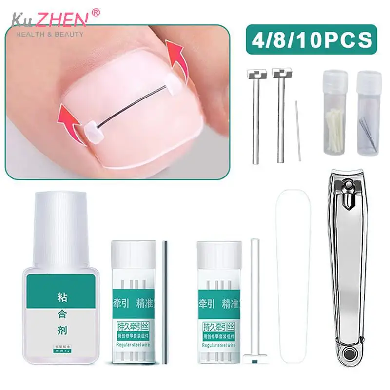 1set Ingrown Toenail Corrector Pedicure Recover Embed Toe Nail Treatment Professional Ingrown Toenail Straightening Clip Brace
