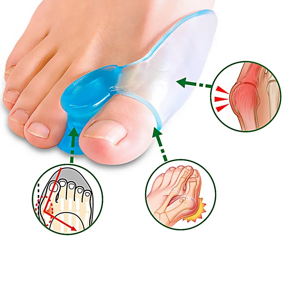 Silicone Toe Separator Finger Feet Care Protector Gel Toe Orthopedic Bunion Hallux Valgus Corrector Pedicure Spacer