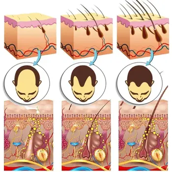 12 best sales Tóc mọc - №7