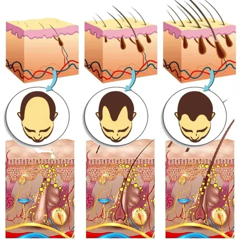 7 दिन अदरक बाल विकास सीरम तेजी से बाल पुनः विकास को बढ़ावा देने के उत्पाद बाल झड़ने की रोकथाम खोपड़ी गंजापन की मरम्मत बालों की जड़ों की देखभाल पोषण 12 best sales बाल उगना - №7