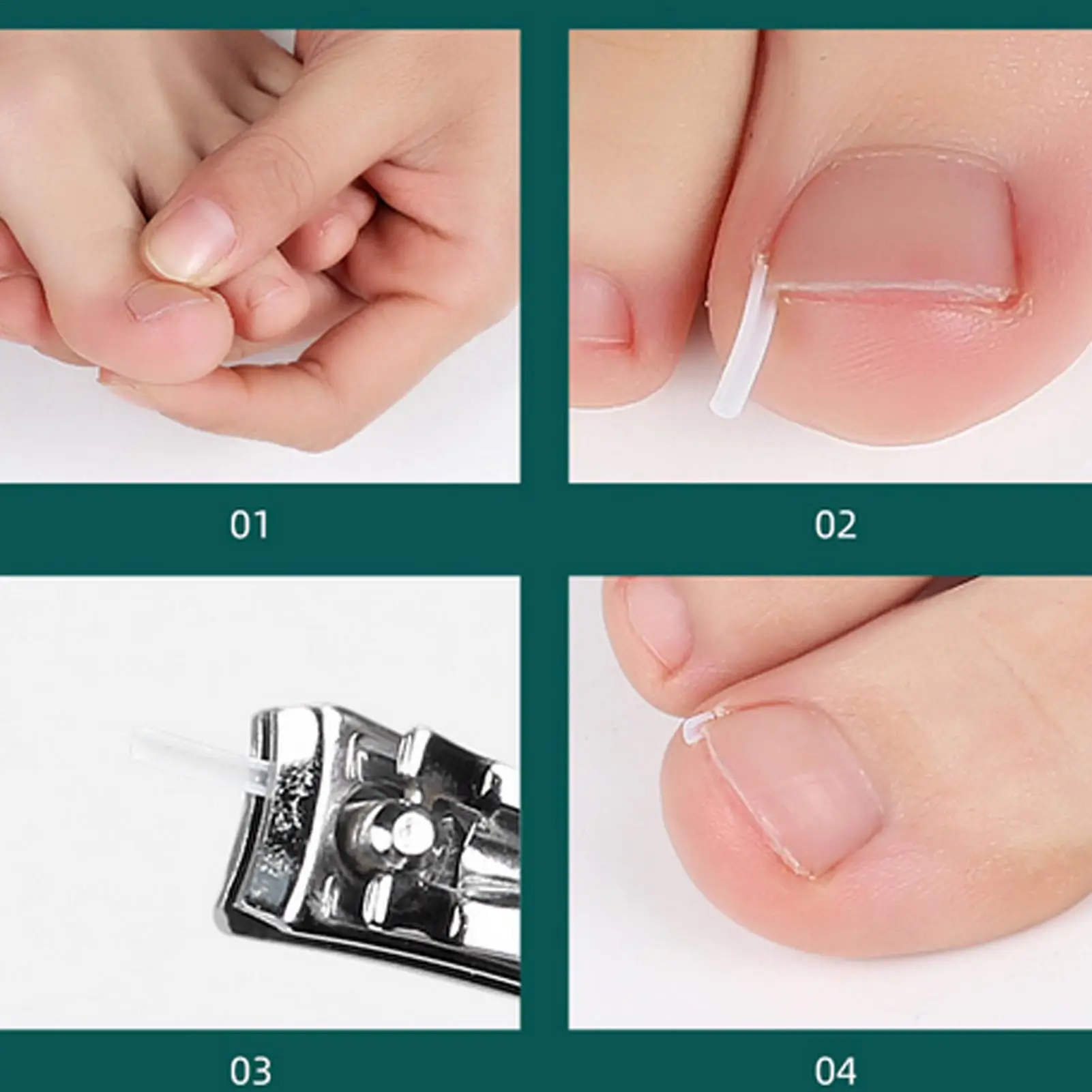 مصحح أظافر نام منحني أظافر مصحح مريح مسمار رافع باديكير بقع للمنزل المسنين رياضي مانيكير