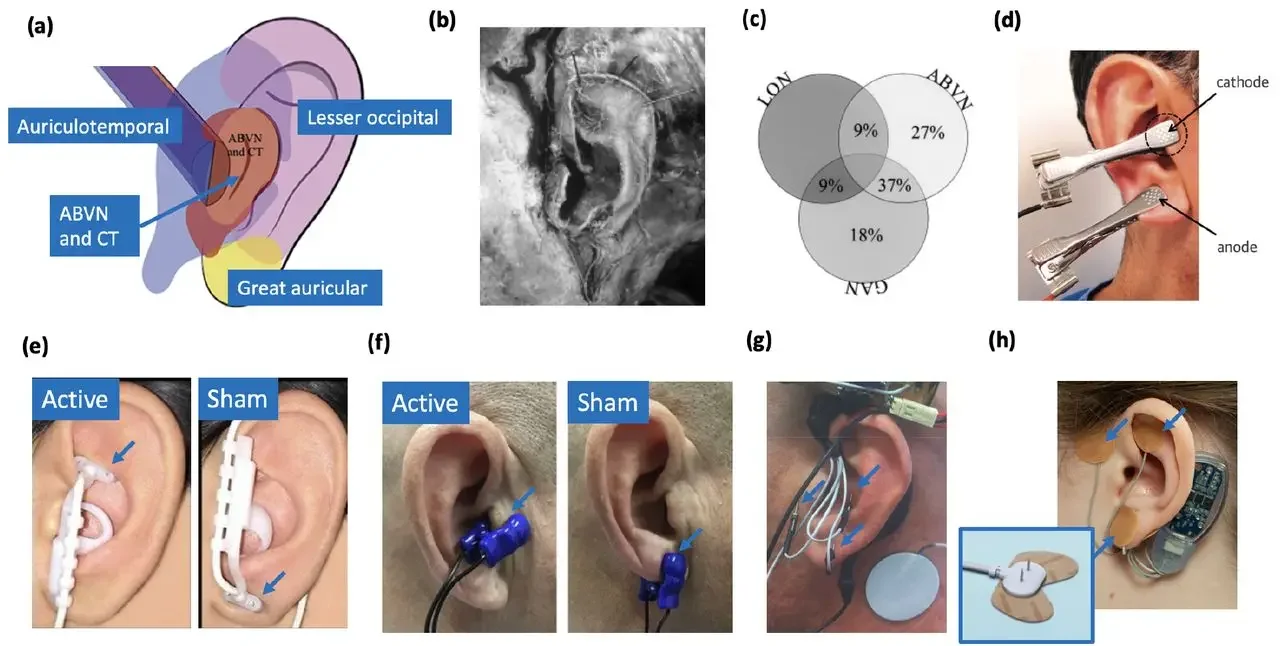 Transcranial Tens trans tVNS Stress Relief Skulanial Electro ear vagus parasympattetyczny stymulator nerwów stymulacja z klipsem