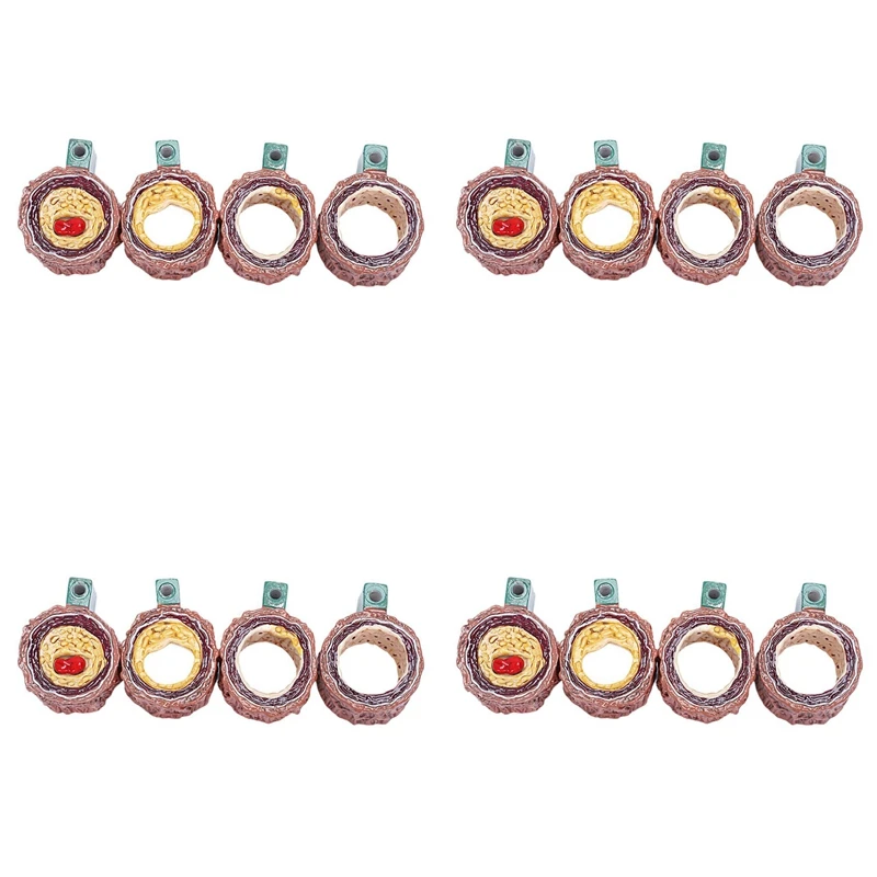 

4X Atherosclerosis Thrombosis Model Vascular Disease Demonstration Heart Vascular Pathology Model