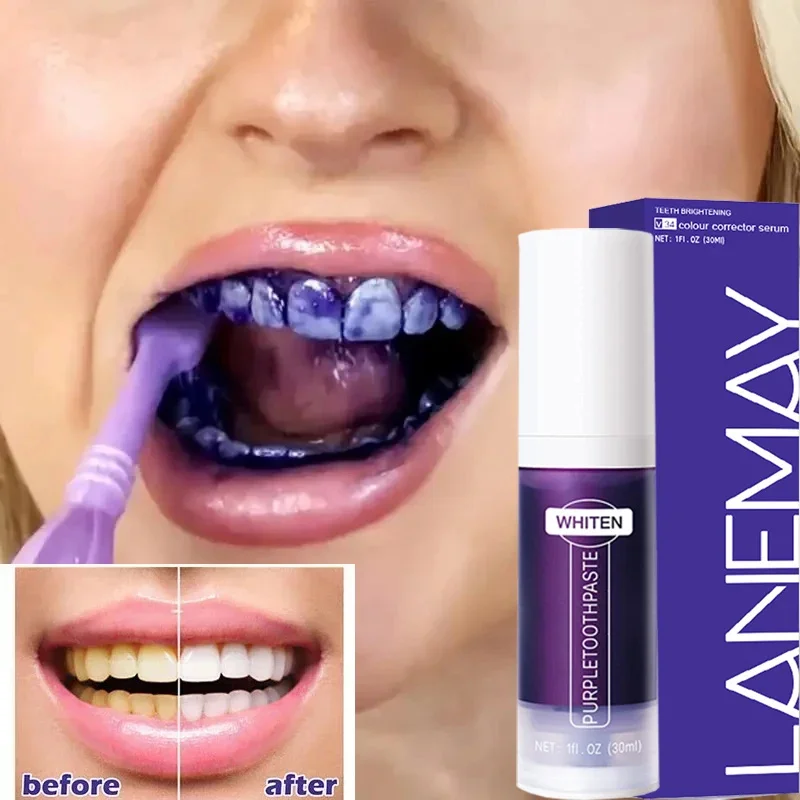 Purple Teeth Whitening Toothpaste, Remover manchas de placa, Limpeza Higiene Oral, Ferramentas Dentárias, Hálito Fresco, Beleza, Cuidados de Saúde, V34