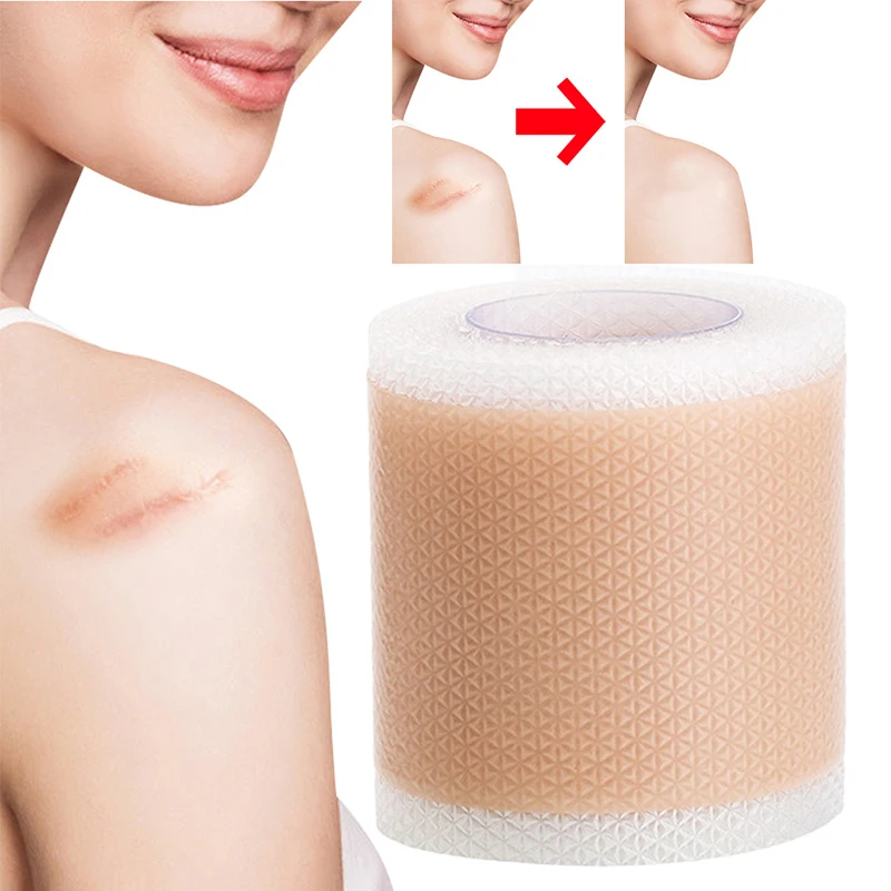 Silicone Scar Patch Nude Scar Tape Roll Scar Sheet Removal Self-Adhesive Tape Therapy Patch Burn  Surgical Scar Skincare
