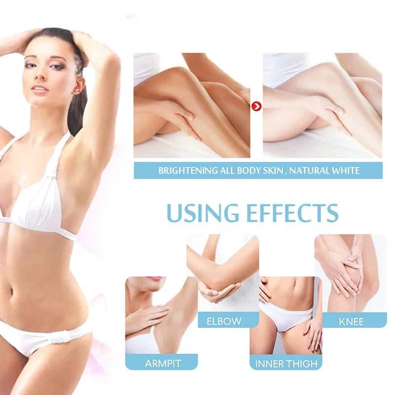 Body Whitening Cream Private Parts Underarm Legs Knee Elbow Brighten Armpit Bleaching Cream Remove Dark Spots Melanin Skin Care