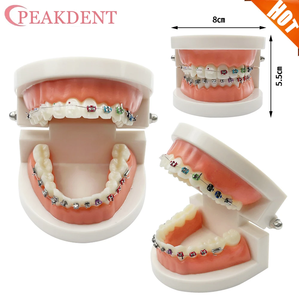 

Orthodontic Teeth Model With Self Ligating Metal Bracket Ceramic Braces Typodont Demonstration Tools For Patient Communication
