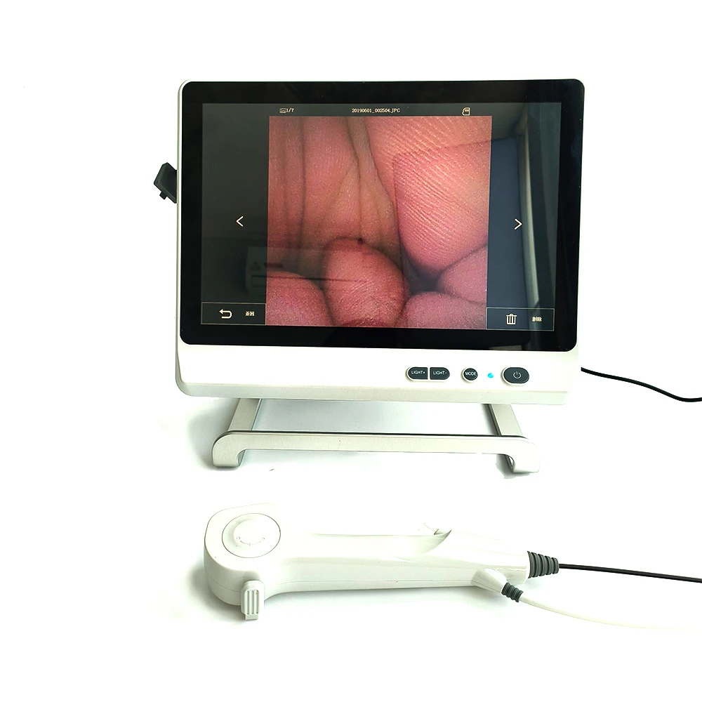 Digital Single Use Flexible Disposable Veterinary Urology Ureteroscope