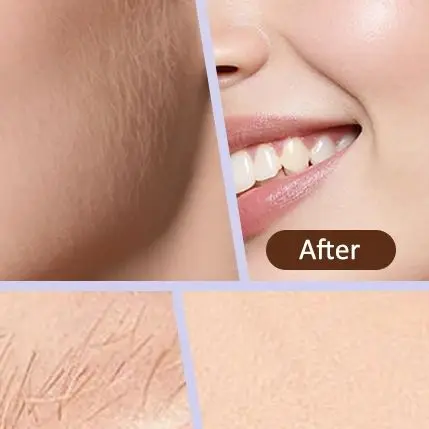 

Электрический дермапланинг-аппарат Sonic для женщин, перезаряжаемая бритва для лица с тремя скоростями, для отшелушивания кожи и удаления пушковых волосков