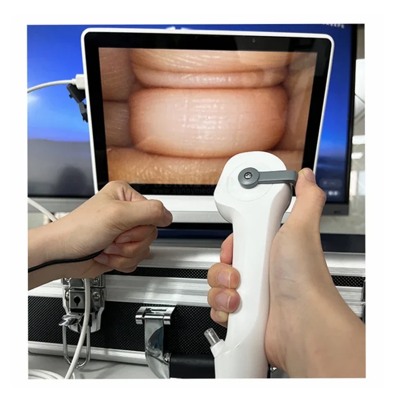 2.8-5.8mm Flexible Ureteroscope Optical Fiber Camera Stomach Endoscope For Pet Animals